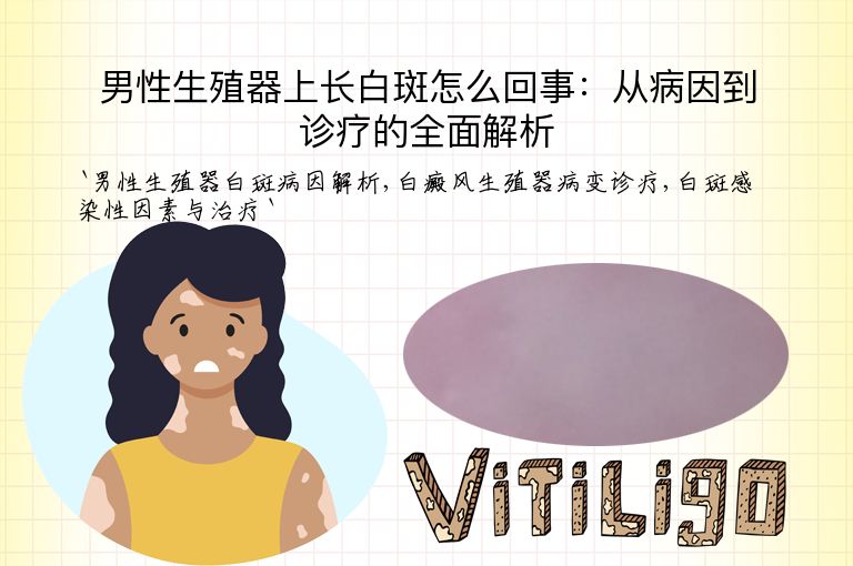 男性生殖器上长白斑怎么回事:从病因到诊疗的全面解析