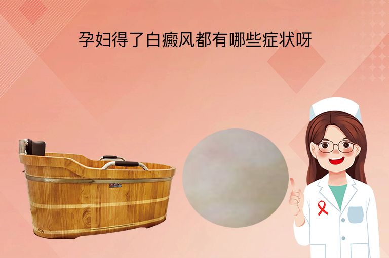 孕妇得了白癜风都有哪些症状呀