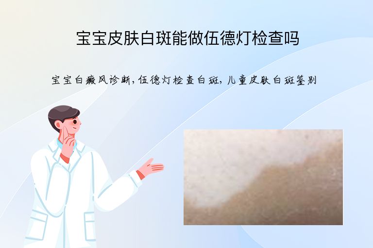 宝宝皮肤白斑能做伍德灯检查吗”