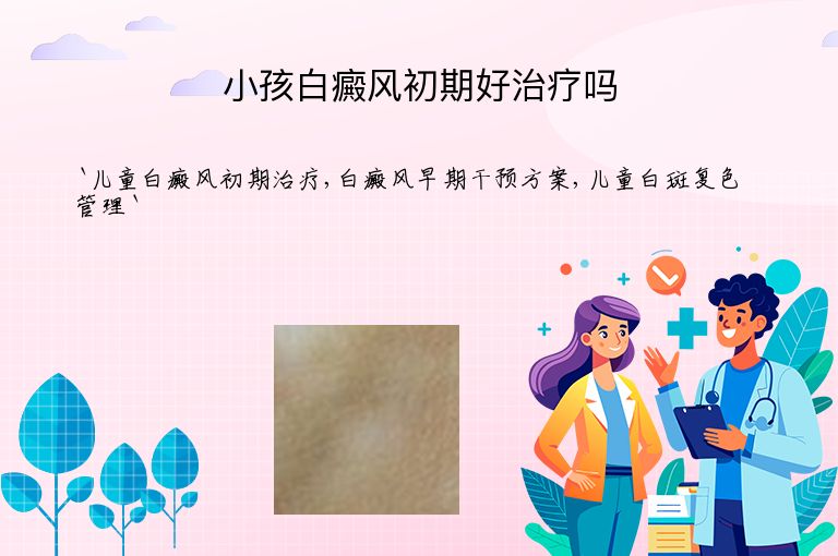 小孩白癜风初期好治疗吗