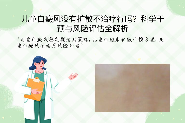 儿童白癜风没有扩散不治疗行吗？科学干预与风险评估全解析