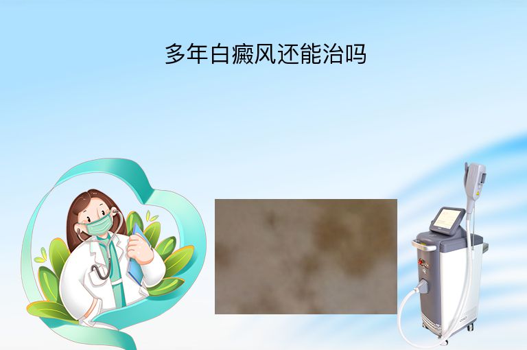 多年白癜风还能治吗”