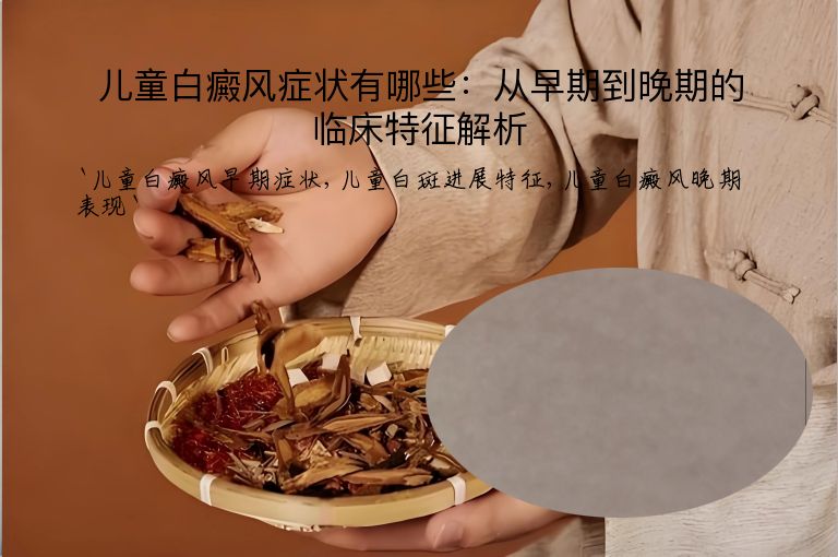 儿童白癜风症状有哪些：从早期到晚期的临床特征解析