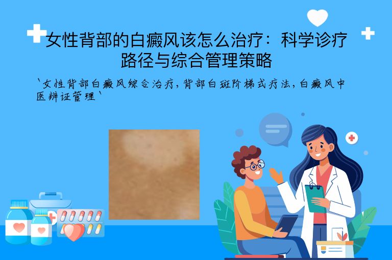 女性背部的白癜风该怎么治疗：科学诊疗路径与综合管理策略