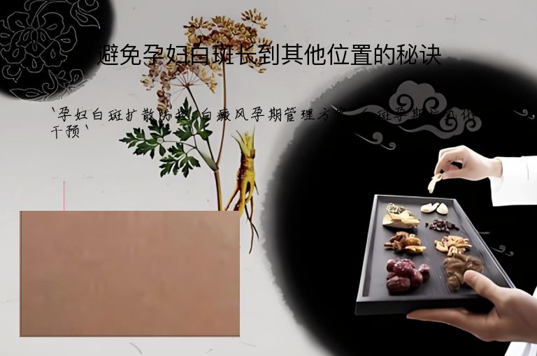 避免孕妇白斑长到其他位置的秘诀