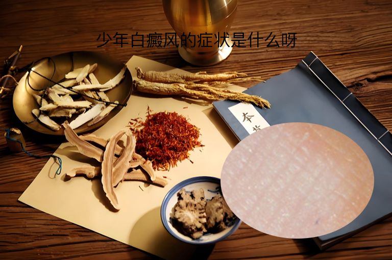 少年白癜风的症状是什么呀”