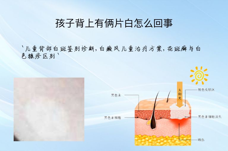 孩子背上有俩片白怎么回事