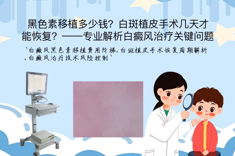 黑色素移植多少钱?白斑植皮手术几天才能恢复?——专业解析白癜风治疗关键问题”