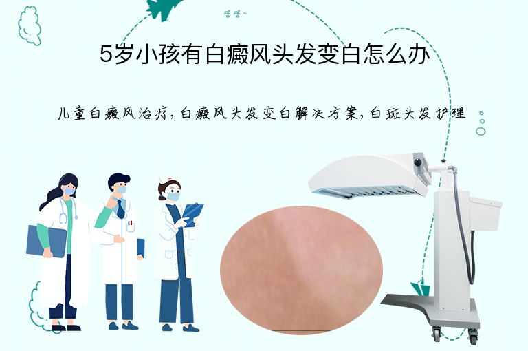 5岁小孩有白癜风头发变白怎么办”