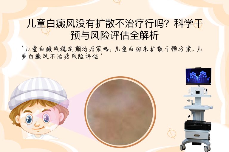 儿童白癜风没有扩散不治疗行吗？科学干预与风险评估全解析