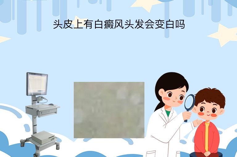 https://www.bdfsjzyy.com/d/file/p/def62f3367b212cc0b69ffa12f44be60.jpeg