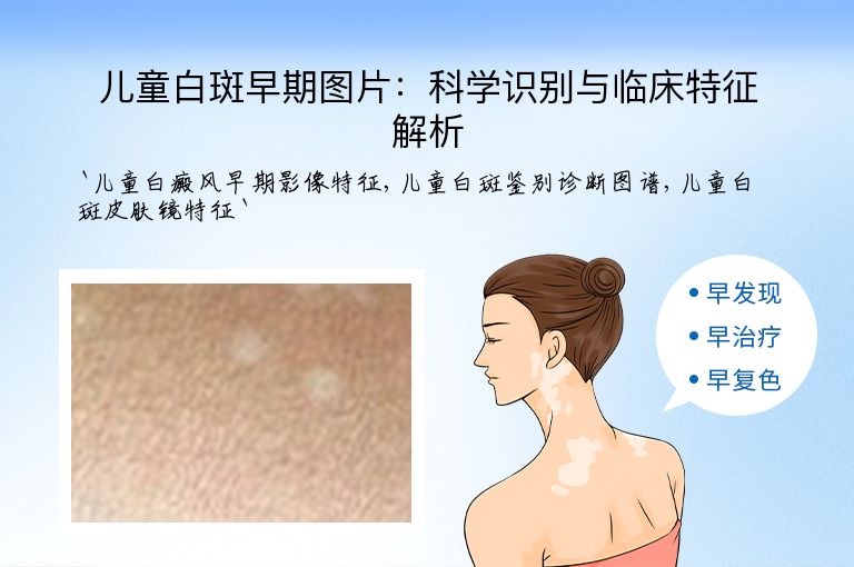 儿童白斑早期图片:科学识别与临床特征解析