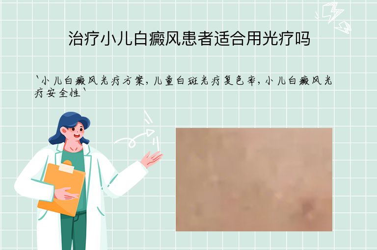 治疗小儿白癜风患者适合用光疗吗