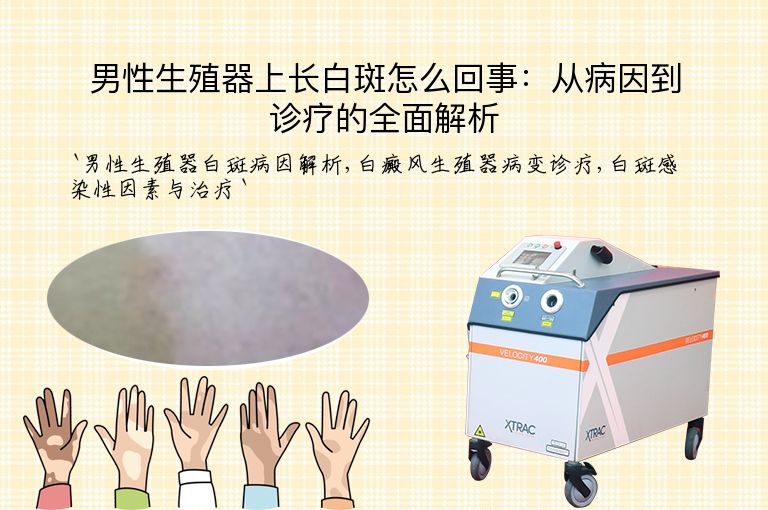 男性生殖器上长白斑怎么回事:从病因到诊疗的全面解析