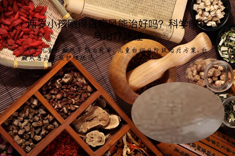 两岁小孩刚得白癜风能治好吗？科学解析与治疗路径”