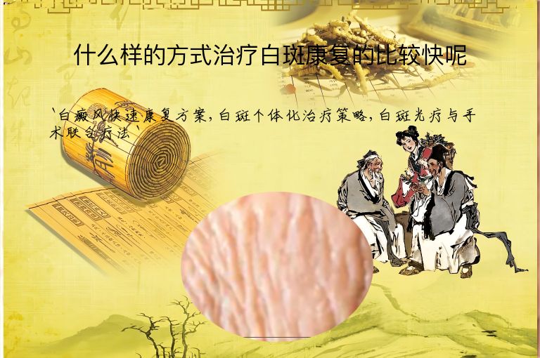 什么样的方式治疗白斑康复的比较快呢