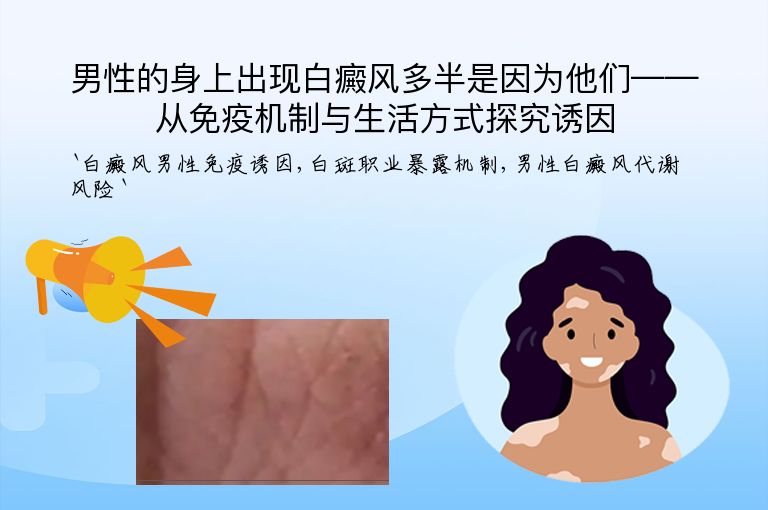 男性的身上出现白癜风多半是因为他们——从免疫机制与生活方式探究诱因