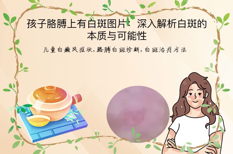 孩子胳膊上有白斑图片:深入解析白斑的本质与可能性”
