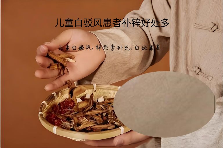 儿童白驳风患者补锌好处多”