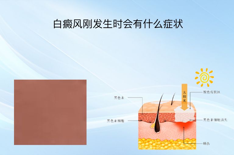 https://www.bdfsjzyy.com/d/file/p/e821af7d2fe24bde844913af9c10a7e1.jpeg