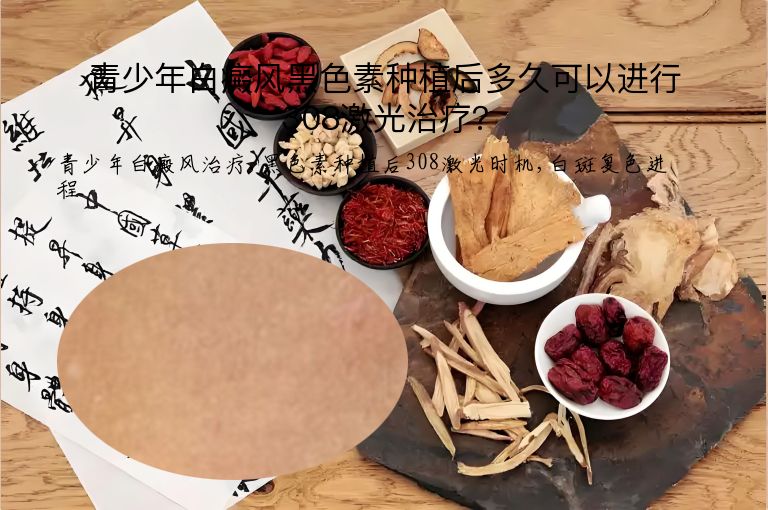 青少年白癜风黑色素种植后多久可以进行308激光治疗？”