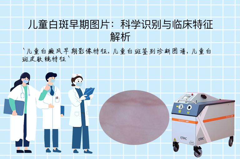 儿童白斑早期图片：科学识别与临床特征解析