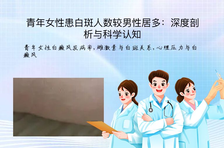 青年女性患白斑人数较男性居多:深度剖析与科学认知”