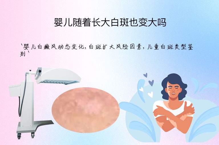 婴儿随着长大白斑也变大吗”
