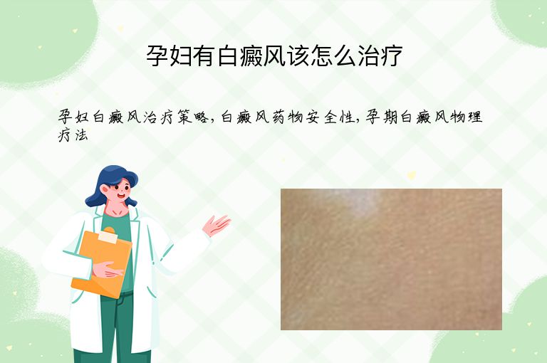 孕妇有白癜风该怎么治疗”