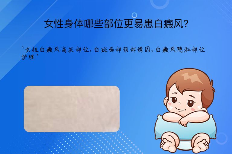 女性身体哪些部位更易患白癜风？”