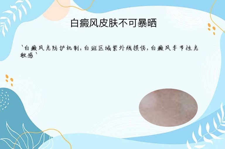 白癜风皮肤不可暴晒