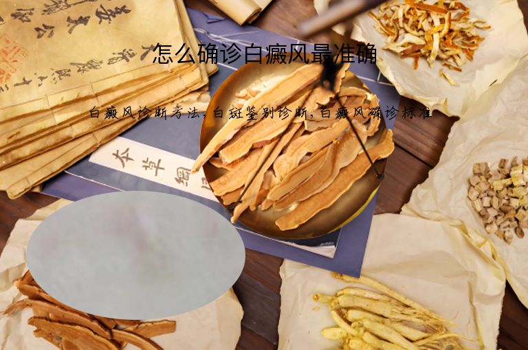 怎么确诊白癜风最准确”