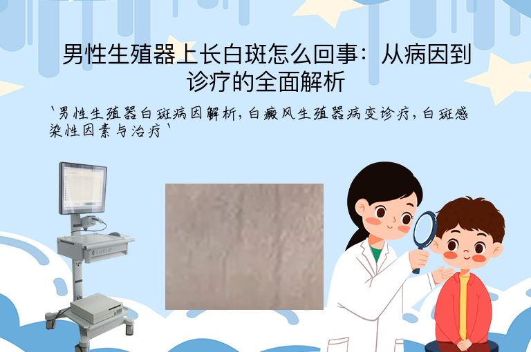 男性生殖器上长白斑怎么回事:从病因到诊疗的全面解析