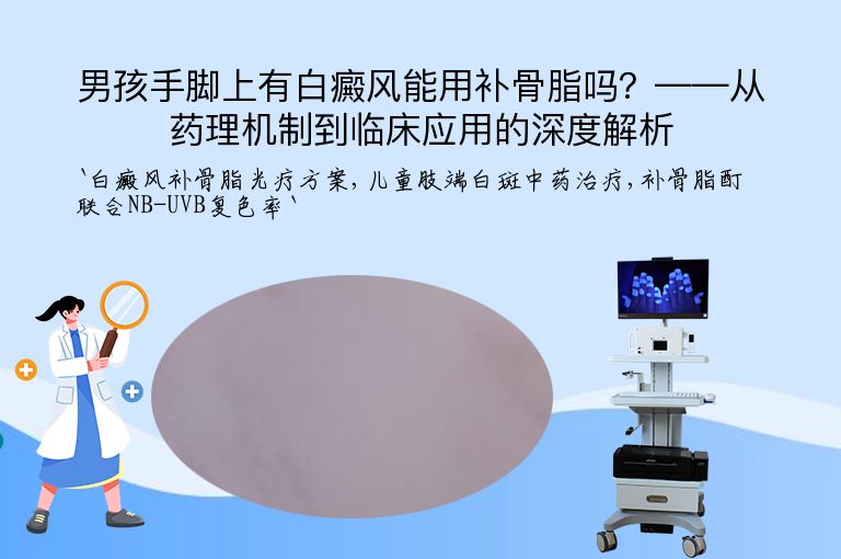 男孩手脚上有白癜风能用补骨脂吗?——从药理机制到临床应用的深度解析