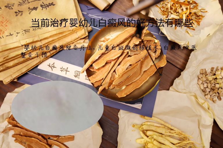 当前治疗婴幼儿白癜风的好方法有哪些”