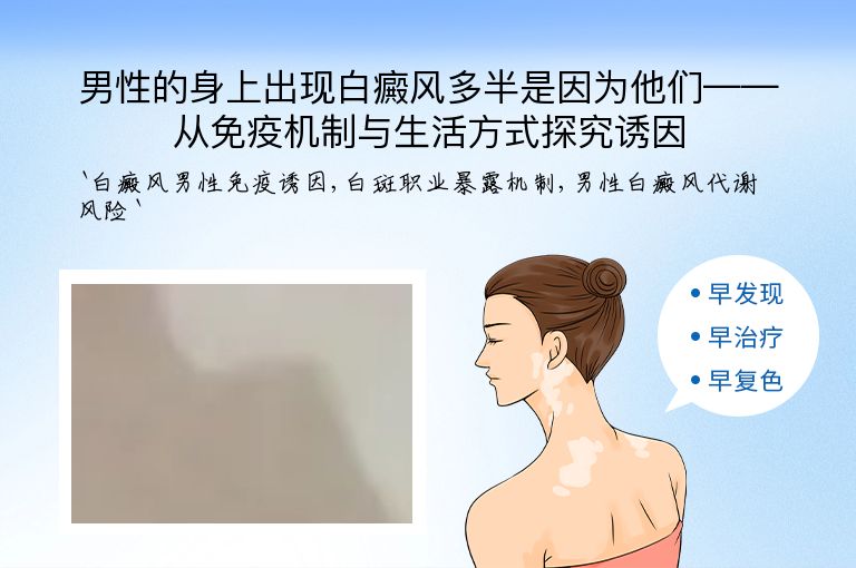 男性的身上出现白癜风多半是因为他们——从免疫机制与生活方式探究诱因