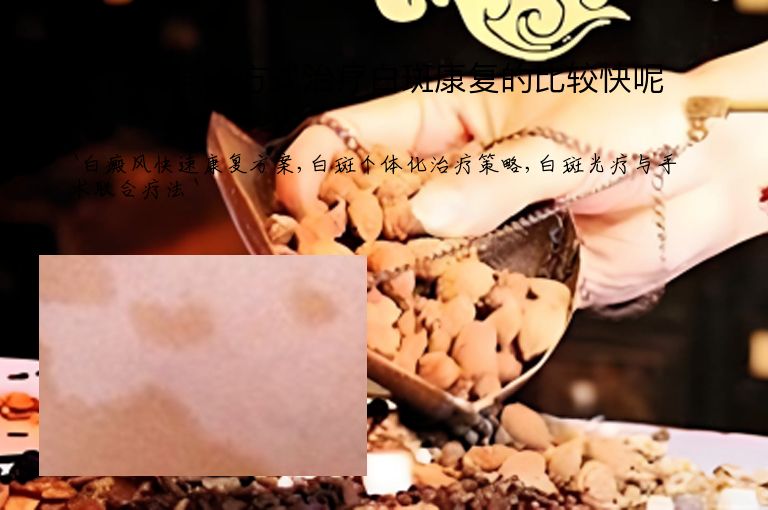 什么样的方式治疗白斑康复的比较快呢