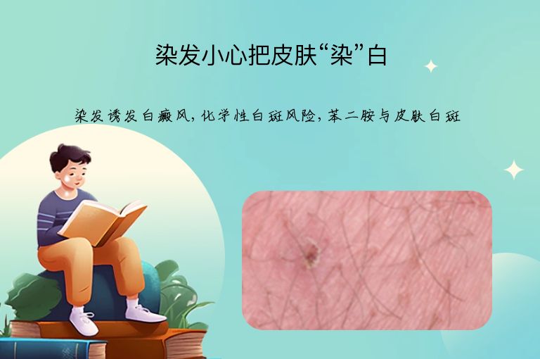 染发小心把皮肤“染”白”