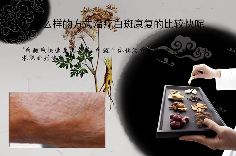什么样的方式治疗白斑康复的比较快呢
