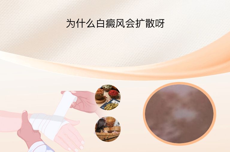 https://www.bdfsjzyy.com/d/file/p/2912ff6136ab1120932a4755c3f21681.jpeg