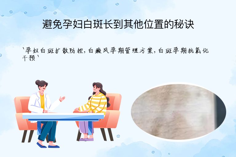 避免孕妇白斑长到其他位置的秘诀