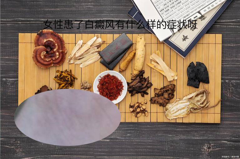 https://www.bdfsjzyy.com/d/file/p/642a5a20df815d175380474286b73e45.jpeg
