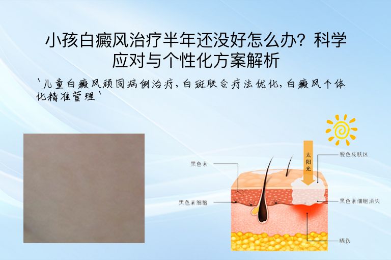 小孩白癜风治疗半年还没好怎么办？科学应对与个性化方案解析”