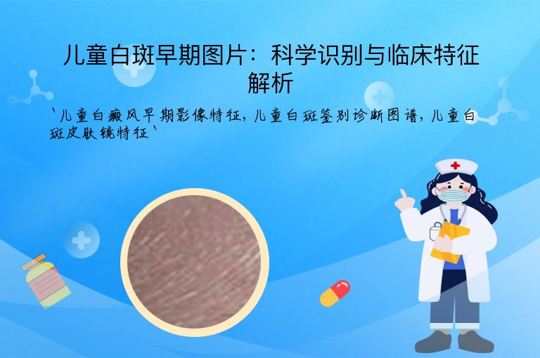 儿童白斑早期图片：科学识别与临床特征解析