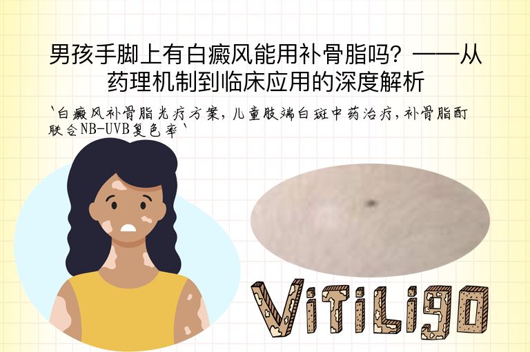 男孩手脚上有白癜风能用补骨脂吗?——从药理机制到临床应用的深度解析