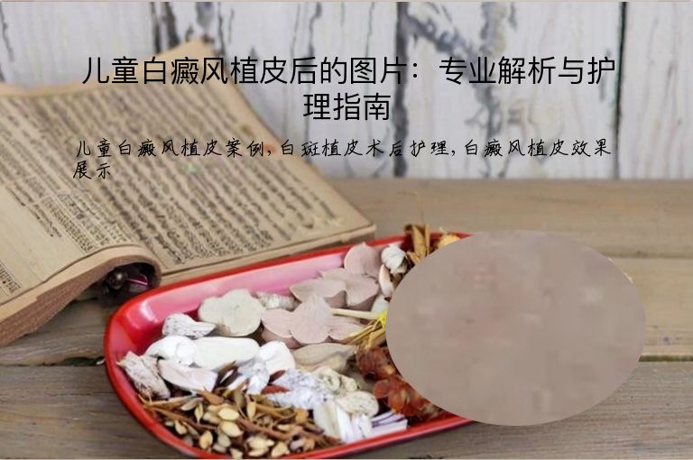 https://www.bdfsjzyy.com/d/file/p/9df3945f10a8c6f932330d5cf9334f20.jpeg