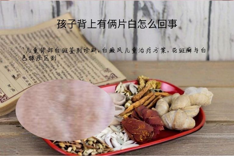 孩子背上有俩片白怎么回事