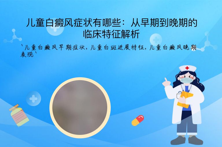 儿童白癜风症状有哪些:从早期到晚期的临床特征解析