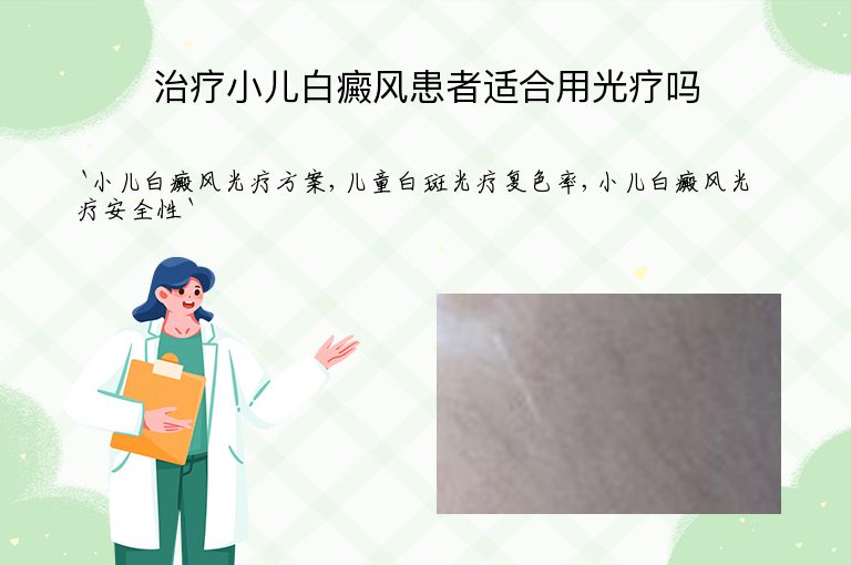 治疗小儿白癜风患者适合用光疗吗