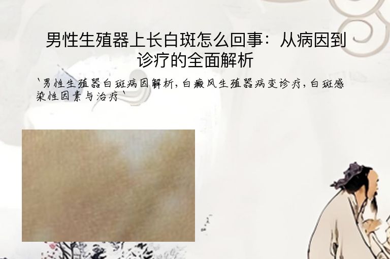 https://www.bdfsjzyy.com/d/file/p/7ca25d99c3c0b06c262d10d07877b3c1.jpeg